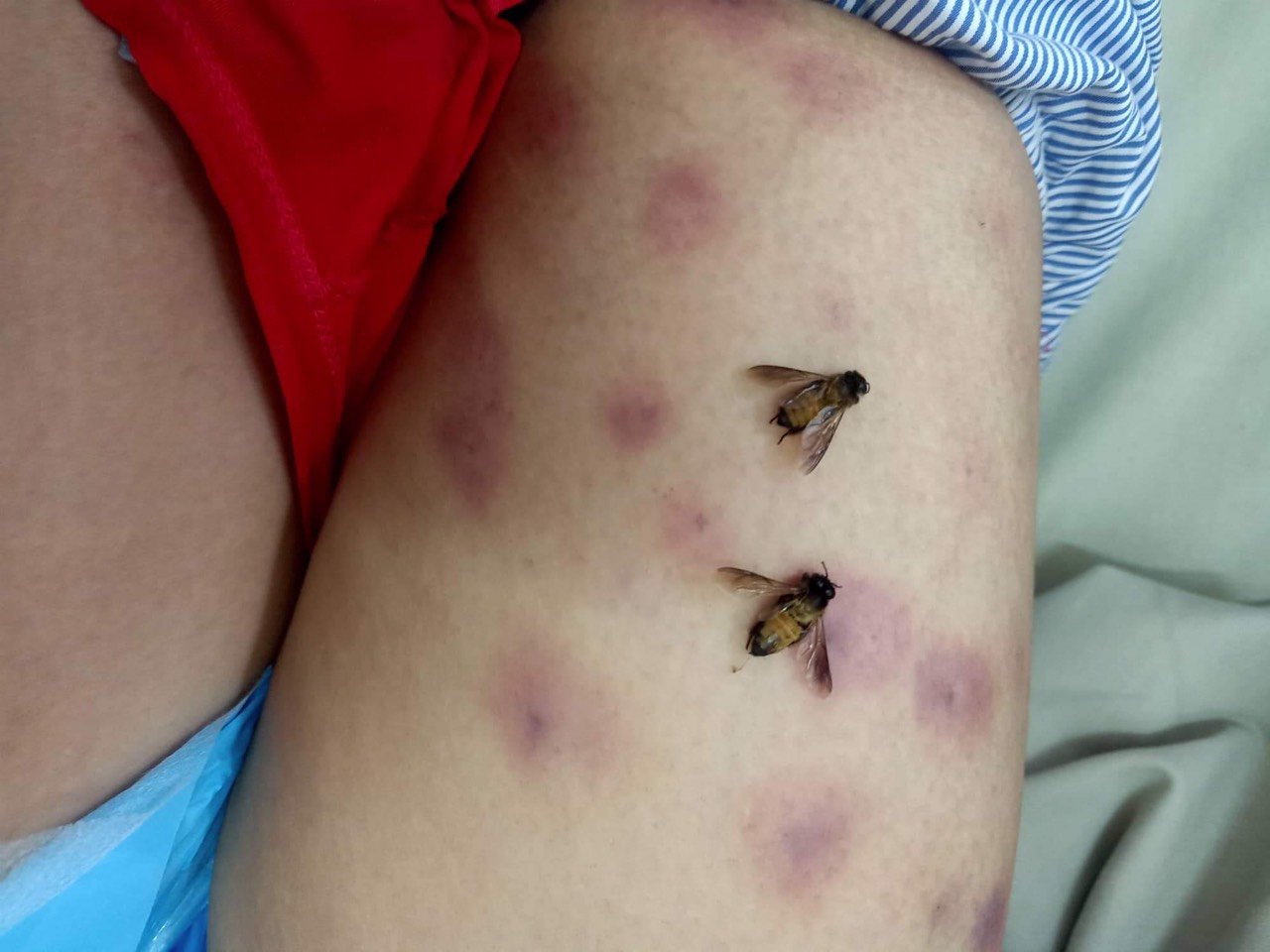 Đang làm cỏ, người phụ nữ bị đàn ong tấn công