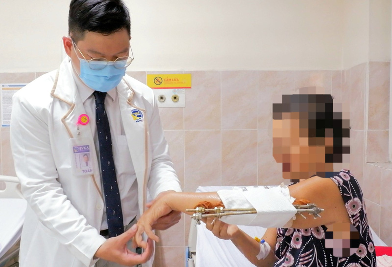 Nhiễm trùng nặng, huỷ xương cánh tay sau khi bó thuốc lá cây
