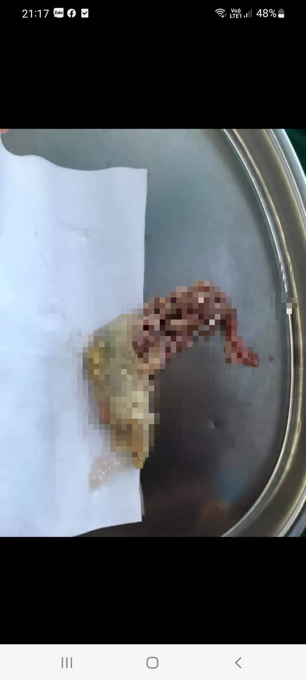 Viên bi trong mũi, cánh gà ngang thực quản: Những ca mắc dị vật khiến bác sĩ thót tim - Ảnh 1.