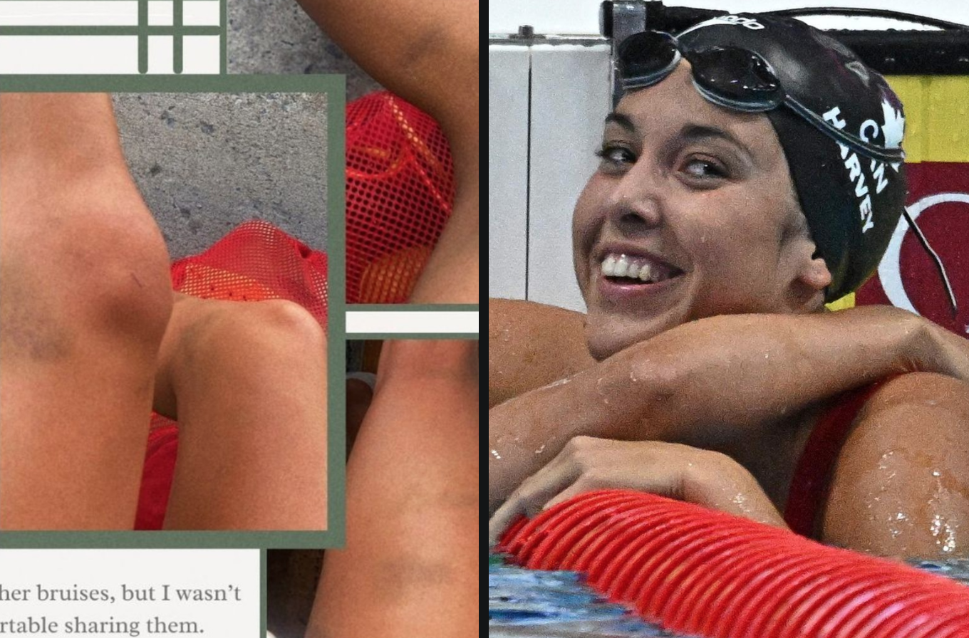 Sốc vụ điều tra kình ngư Canada bị đánh thuốc mê ở giải thế giới Sốc vụ điều tra kình ngư Canada bị đánh thuốc mê ở giải thế giới