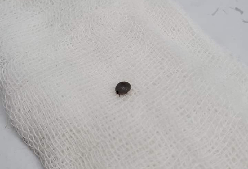 Khám tai đau, bác sĩ gắp ra cả... ve chó, gián còn sống trong tai bệnh nhân