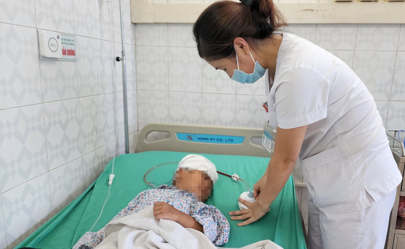 Ngã từ trên cao, bé 4 tuổi bị đinh sắt đâm xuyên xương sọ