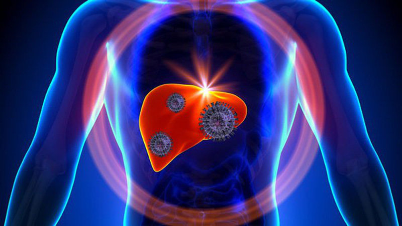 Ngày Thế giới phòng chống viêm gan 28/7: Phát hiện, điều trị sớm bệnh viêm gan virus