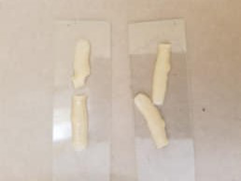 Nhiễm sán dây vì thường xuyên ăn đồ tái, ăn gỏi, tiết canh