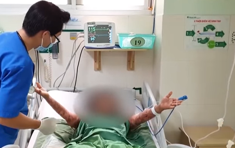 Nổi bóng nước toàn thân vì dị ứng thuốc