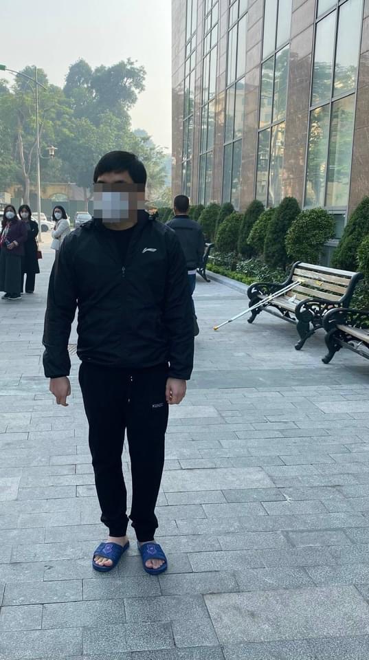 Kỳ tích mới: Kéo dài chân tới... 18 cm cho chàng trai mắc dị tật chân cao chân thấp