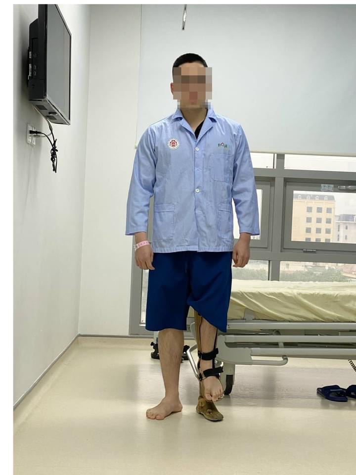 Kỳ tích mới: Kéo dài chân tới... 18 cm cho chàng trai mắc dị tật chân cao chân thấp