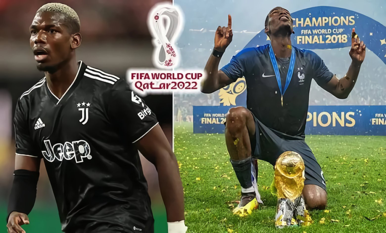 Để đá World Cup 2022, Pogba sẽ phải uống thuốc giảm đau liên tục