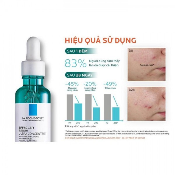 Review tất tần tật về serum trị mụn La Roche Posay Effaclar Ultra Concentrated Serum