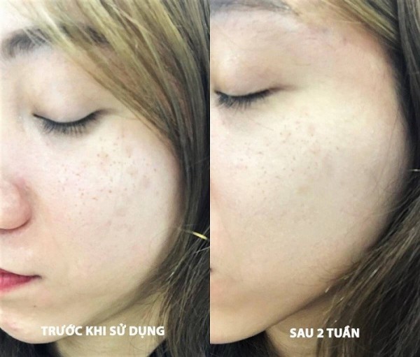 Review kem dưỡng trắng da ban đêm Eucerin Ultra White Spotless Night Cream