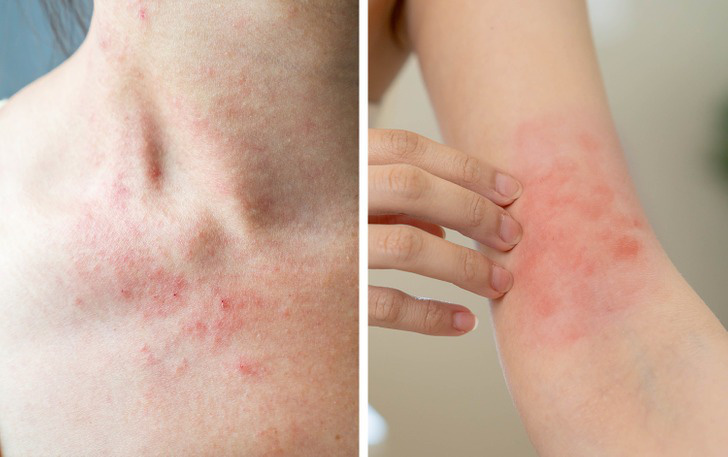Những dấu hiệu bất thường của cơ thể mà bạn không nên bỏ qua Những dấu hiệu bất thường của cơ thể mà bạn không nên bỏ qua