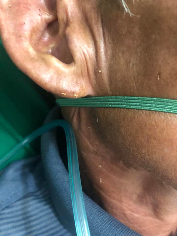 Sơn La: Nhiều người bị ong đốt nhập viện, có trường hợp tử vong