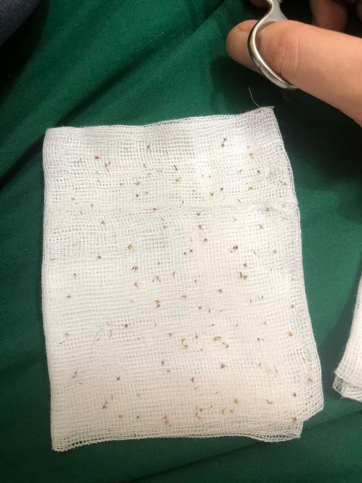 Sơn La: Nhiều người bị ong đốt nhập viện, có trường hợp tử vong