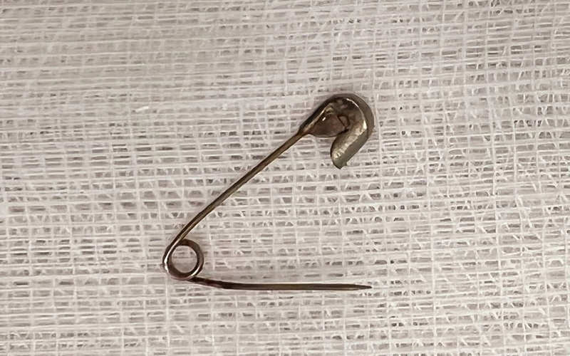 Bé 6 tháng tuổi suýt bị kim băng đâm thủng dạ dày