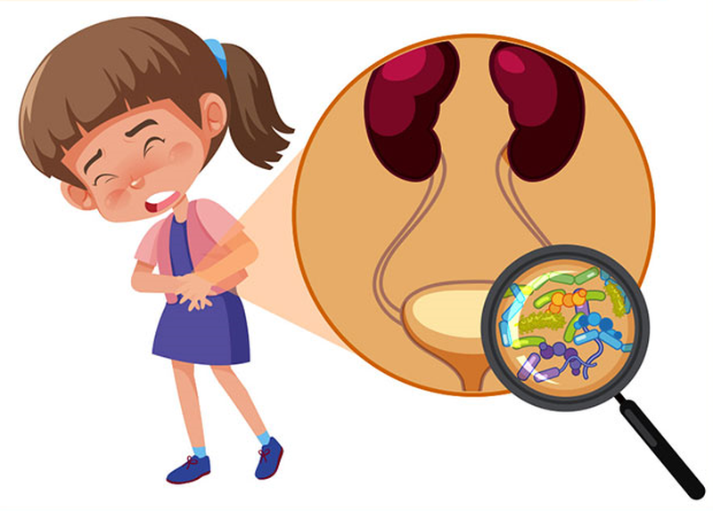 Cẩn trọng bệnh nhiễm khuẩn tiết niệu ở trẻ em