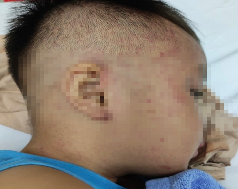 Cấp cứu bé trai 3 tuổi nghi bị bạo hành, nhốt trong tủ cấp đông