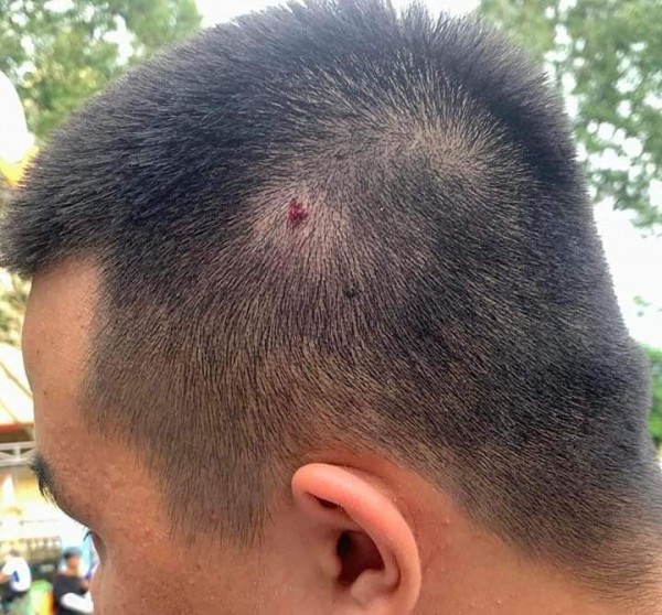 Xôn xao vụ việc thầy giáo dùng thước, nón bảo hiểm đánh vào đầu học sinh Xôn xao vụ việc thầy giáo dùng thước, nón bảo hiểm đánh vào đầu học sinh