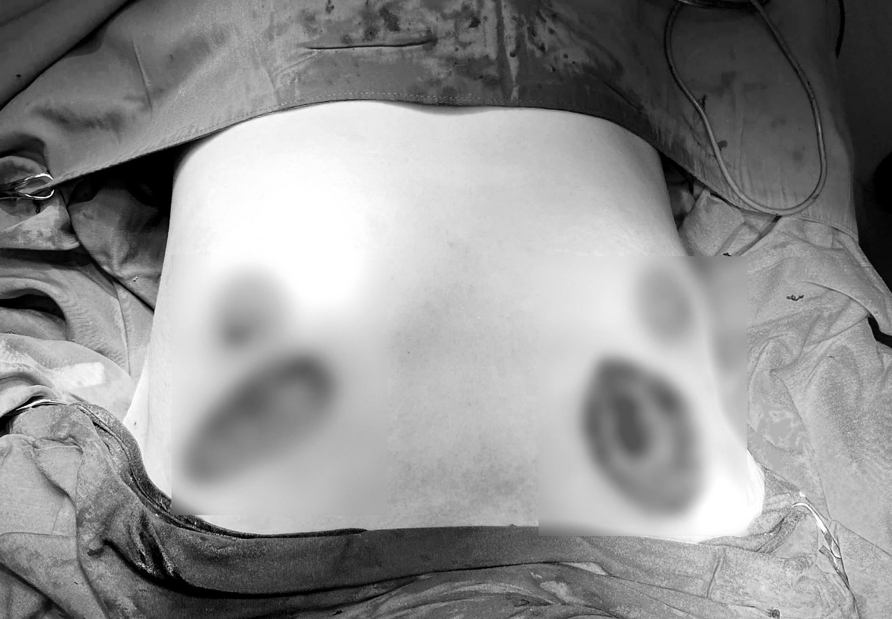 Liên tiếp các ca cấp cứu vì phẫu thuật thẩm mỹ không an toàn