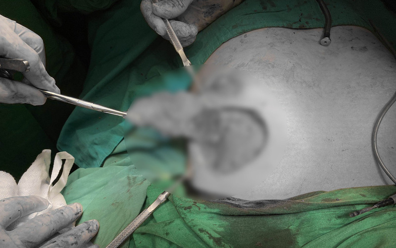 Liên tiếp các ca cấp cứu vì phẫu thuật thẩm mỹ không an toàn