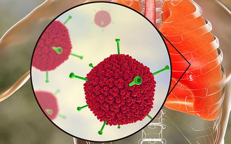 Thêm 1 trẻ tử vong do virus Adeno