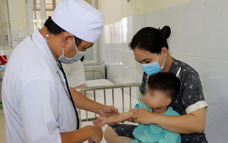 Đồng Nai ghi nhận hơn 6.000 ca mắc tay chân miệng