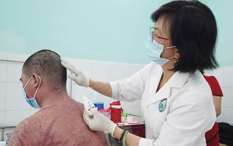 Cẩn trọng khi điều trị bệnh vảy nến bằng thuốc không rõ nguồn gốc trên mạng xã hội