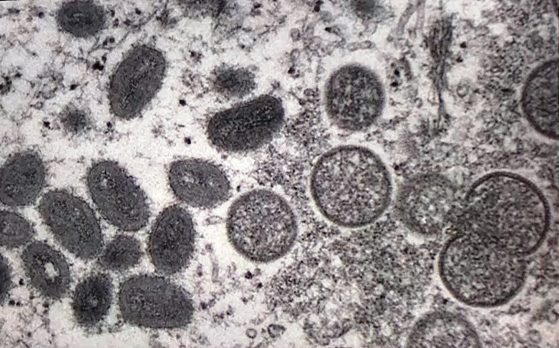 Đậu mùa khỉ được xếp vào bệnh truyền nhiễm nhóm B