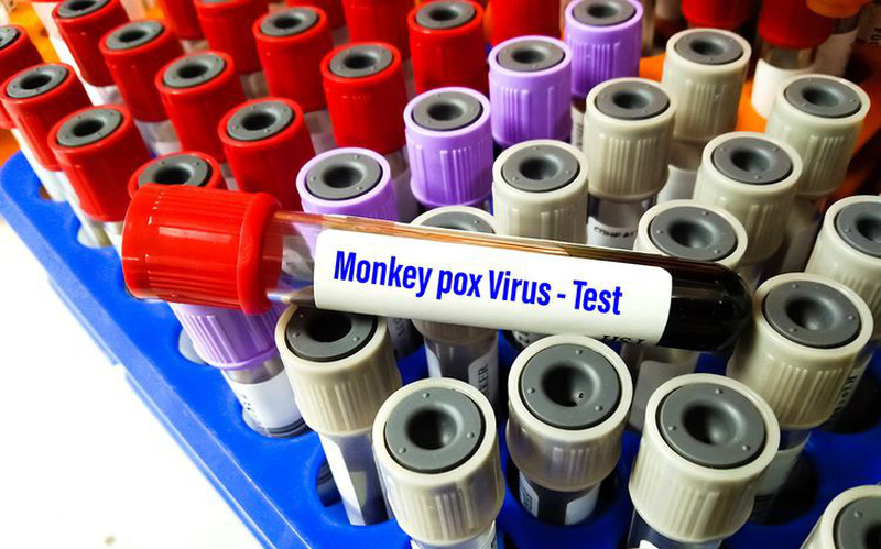 Trường hợp nổi mụn đỏ sau khi trở về từ Nam Phi tại Đắk Lắk âm tính với virus gây bệnh đậu mùa khỉ