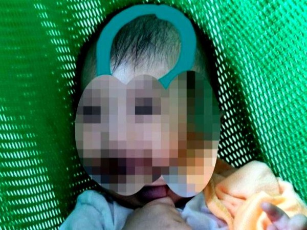 Bạo hành trẻ 6 tháng tuổi ở TP.HCM: Cháu bé dập não, thương tích 99%