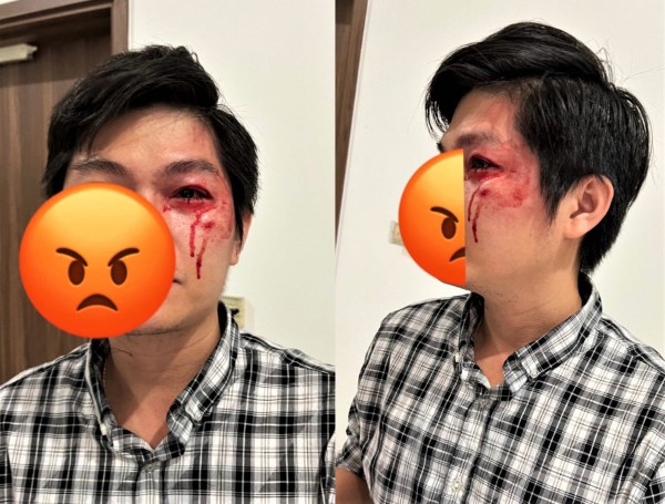 TP.HCM: Yêu cầu xử lý nghiêm vụ chủ chó đánh người ở chung cư Saigon Riverside TP.HCM: Yêu cầu xử lý nghiêm vụ chủ chó đánh người ở chung cư Saigon Riverside