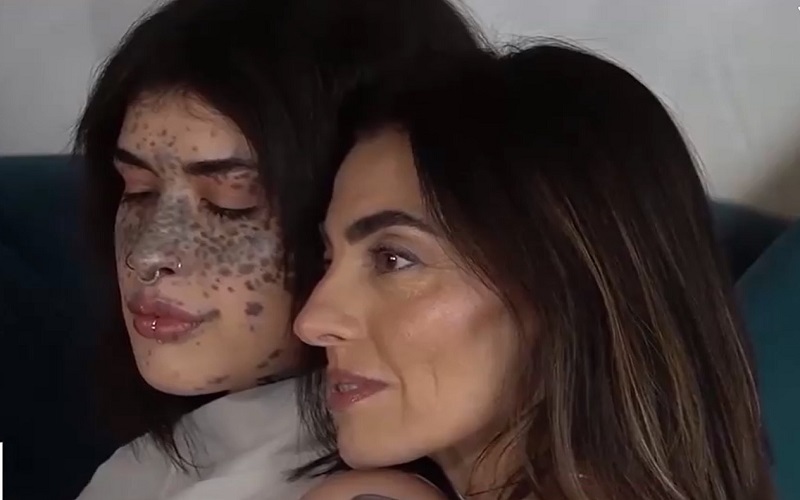 Tôn vinh vẻ đẹp không hoàn hảo tại Italy