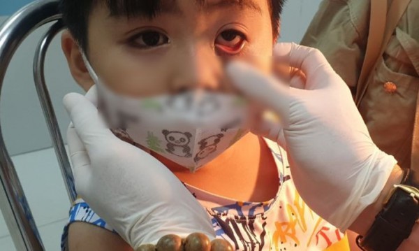 Trẻ mầm non đi học giữa mùa dịch đau mắt đỏ: Bác sĩ khuyên những việc cần làm để phòng bệnh