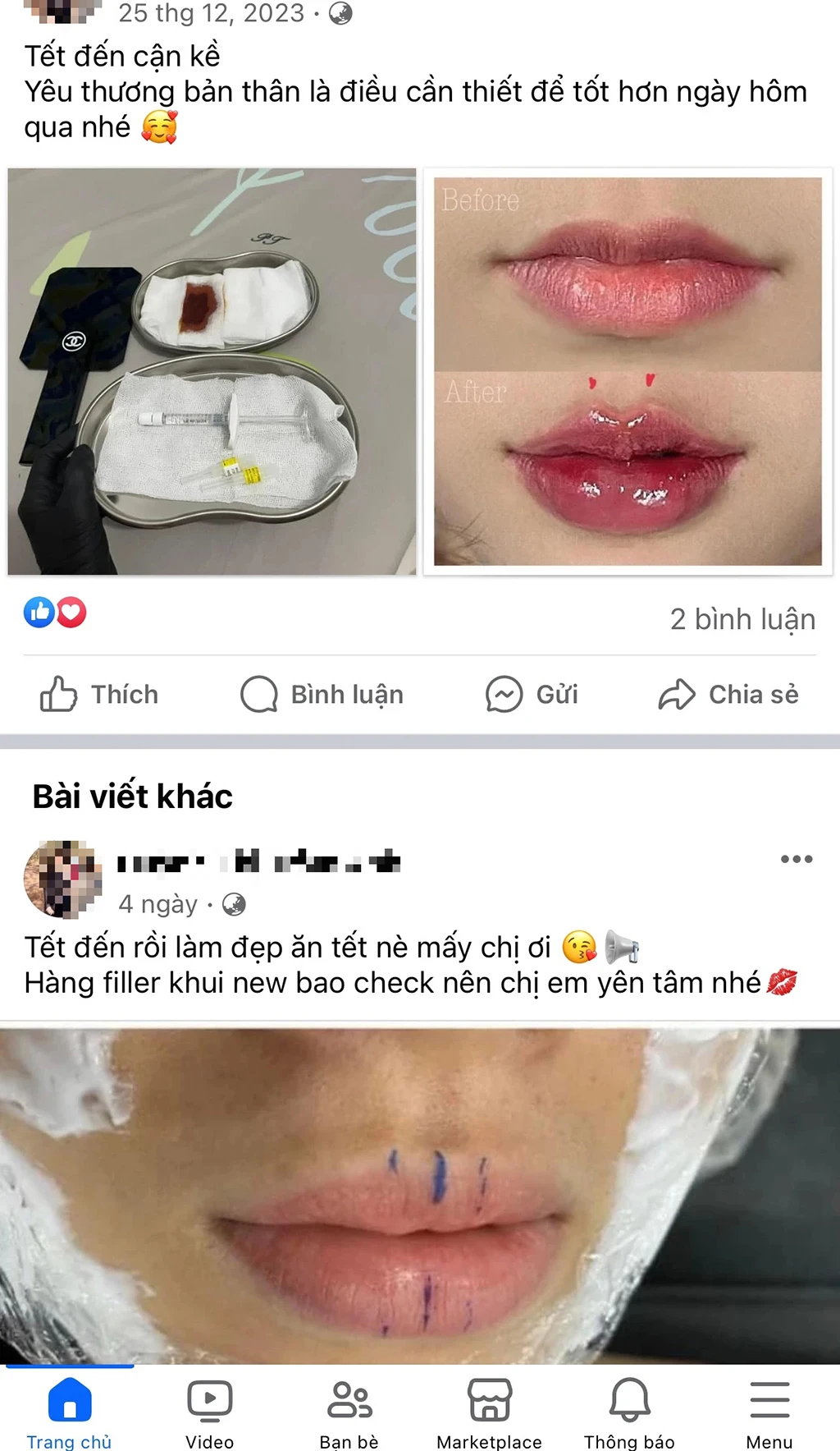 Thẩm mỹ 'chui' cấp tốc lại tung hoành bất chấp- Ảnh 3.