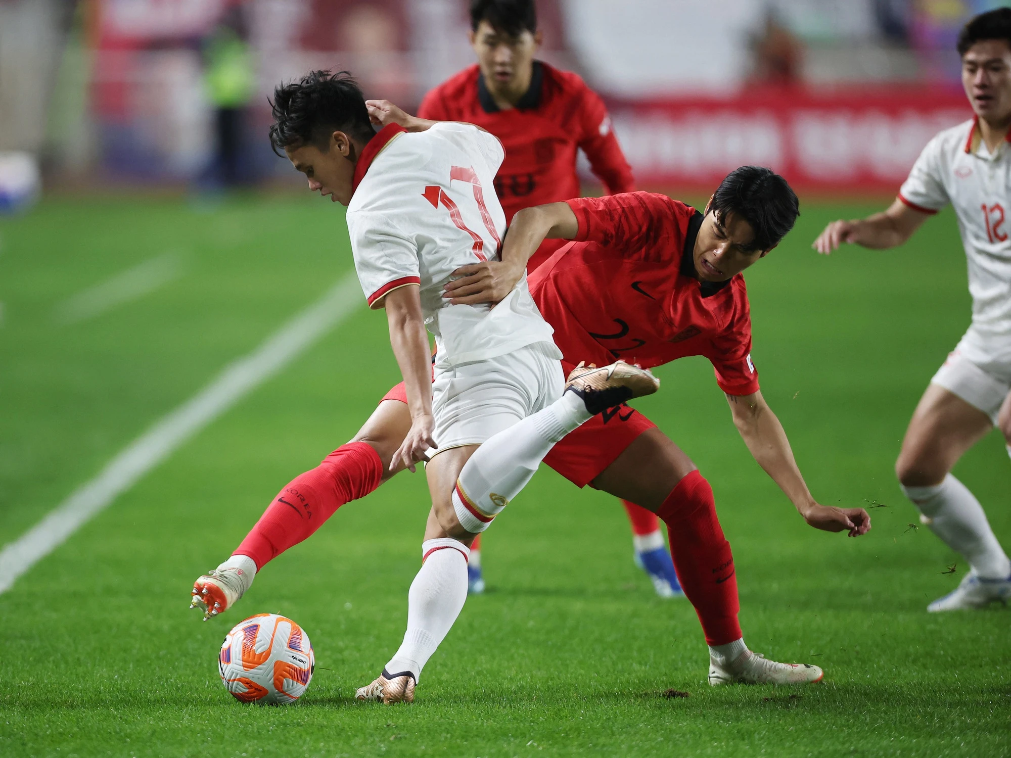 Võ Minh Trọng mổ vai thành công, hết lòng ủng hộ đội U.23 Việt Nam