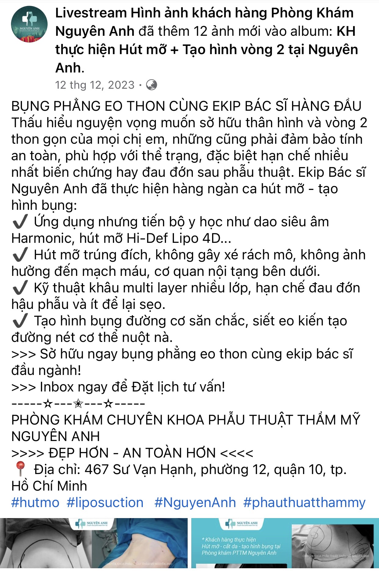 TP.HCM: Nhiều ca biến chứng, tử vong khi làm thẩm mỹ - Ảnh 1.