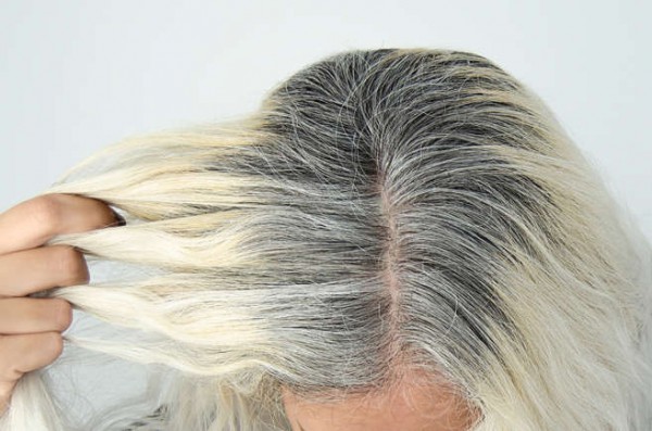 Lý do khiến tóc rụng và bạc nhanh hơn