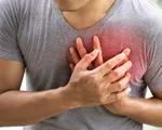 Gần một nửa số người ở độ tuổi 40 có triệu chứng đau tim 'ẩn'