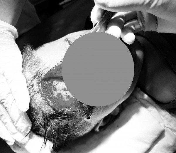 Phú Yên: Bé trai bị chó tấn công, phải nhập viện cấp cứu Phú Yên: Bé trai bị chó tấn công, phải nhập viện cấp cứu