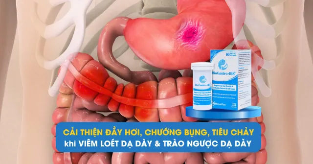 Cải thiện đầy hơi, chướng bụng khi mắc viêm dạ dày, trào ngược dạ dày thực quản - Ảnh 1.