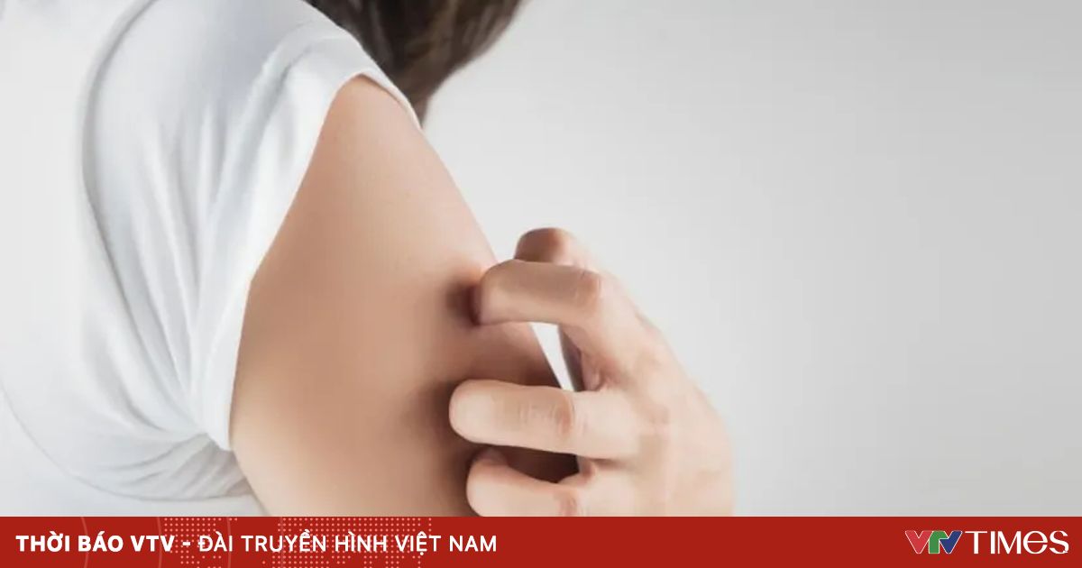 Giải mã cơn ngứa