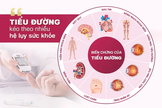 Nutricare Cerna – Dinh dưỡng Y học chuyên biệt giúp ổn định đường huyết, ngăn biến chứng tiểu đường - Ảnh 1. Nutricare Cerna – Dinh dưỡng Y học chuyên biệt giúp ổn định đường huyết, ngăn biến chứng tiểu đường - Ảnh 1.