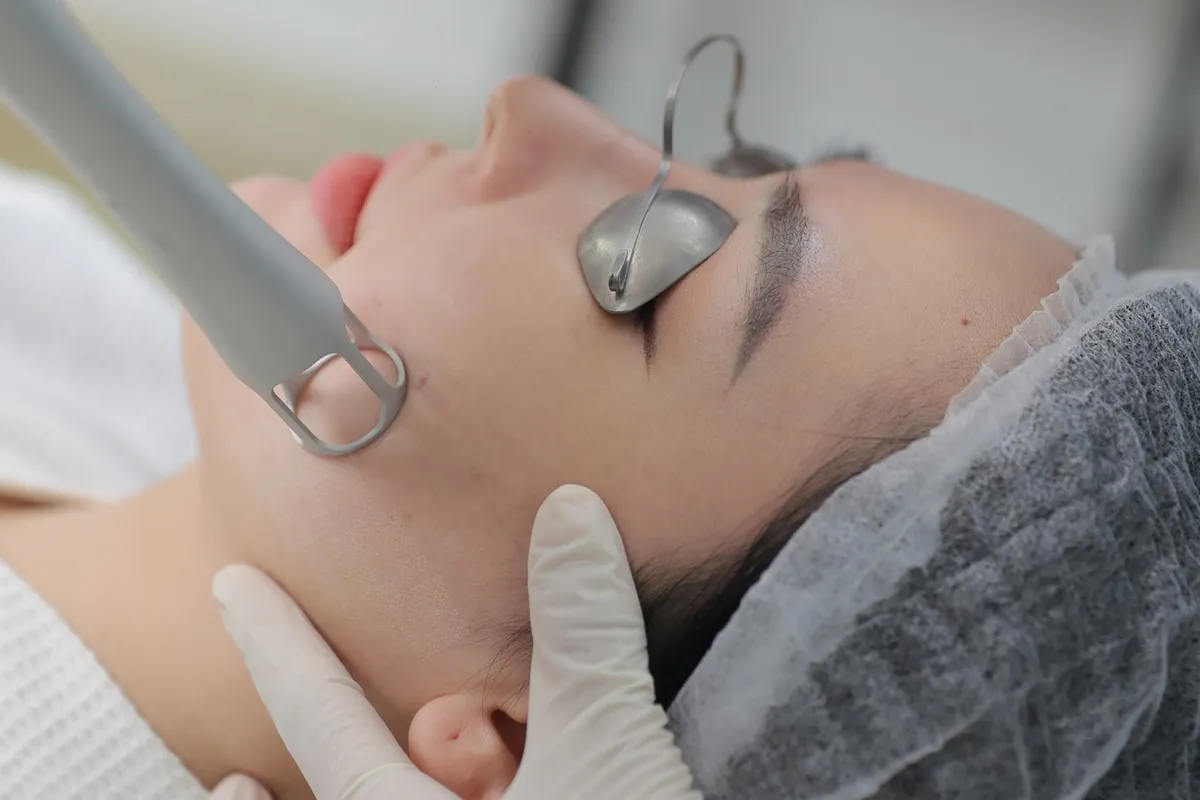 Hiệu quả xử lý rỗ nhăn ngay sau lần đầu liệu trình Mezoclear tại DRH Clinic - Ảnh 2. Hiệu quả xử lý rỗ nhăn ngay sau lần đầu liệu trình Mezoclear tại DRH Clinic - Ảnh 2.