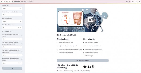 Bác sĩ phát triển AI cảnh báo viêm ruột thừa có biến chứng