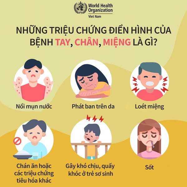 Làm gì khi có dịch tay chân miệng bùng phát trong trường học?