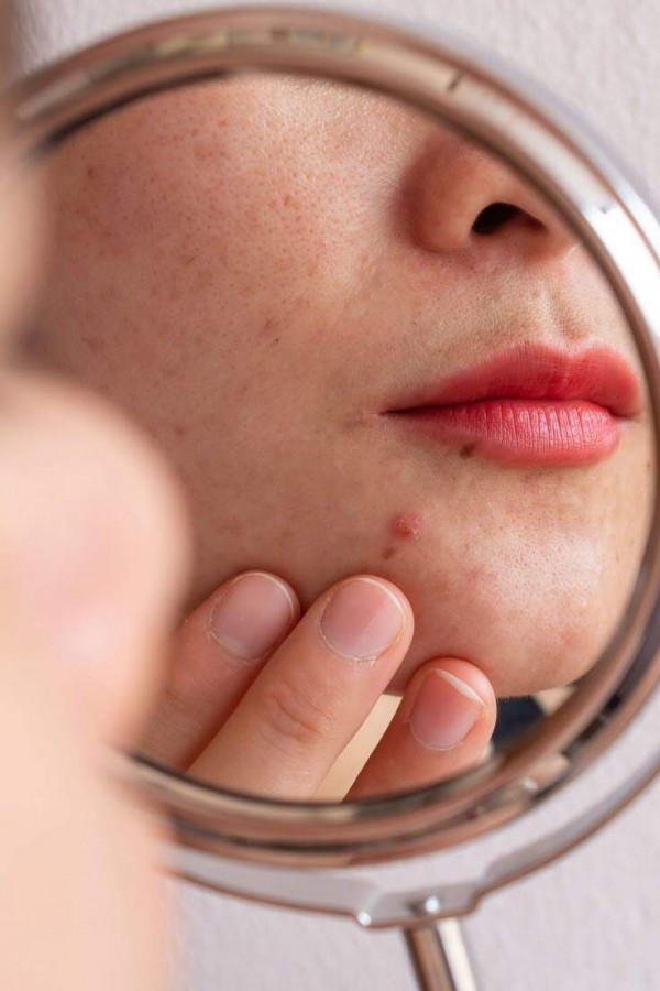 Thói quen trộn kem dưỡng ẩm và kem chống nắng gây hại cho da