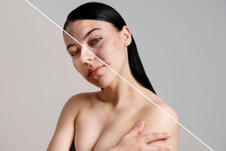 Dùng mặt nạ giấy mỗi ngày có thật sự tốt?