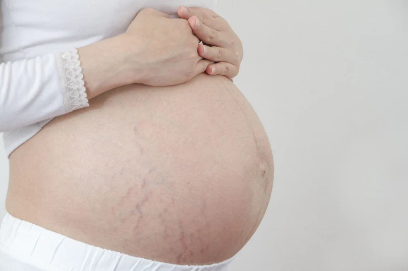 Bí quyết để 9 tháng mang bầu mà da vẫn căng mướt