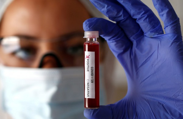 25 bang Mỹ ghi nhận ca Covid-19 tăng, xuất hiện virus khác diễn biến bất thường 25 bang Mỹ ghi nhận ca Covid-19 tăng, xuất hiện virus khác diễn biến bất thường
