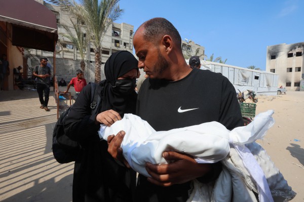 Tình trạng suy dinh dưỡng ở Gaza đến mức báo động Tình trạng suy dinh dưỡng ở Gaza đến mức báo động