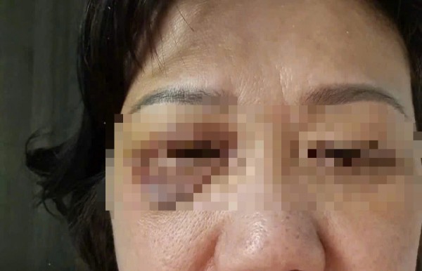 TP.HCM: 2 vợ chồng trẻ hành hung người phụ nữ 60 tuổi tại sảnh chung cư